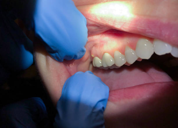Best Emergency Gum Pain Relief  in Levittown, NY